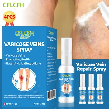 Veenilaiendid Spray Foot Care Medicine Vaskuliit Flebiit Spider Jala Ravi Angiitis Jalad Laienenud Varicosity Leevendust Vedelik